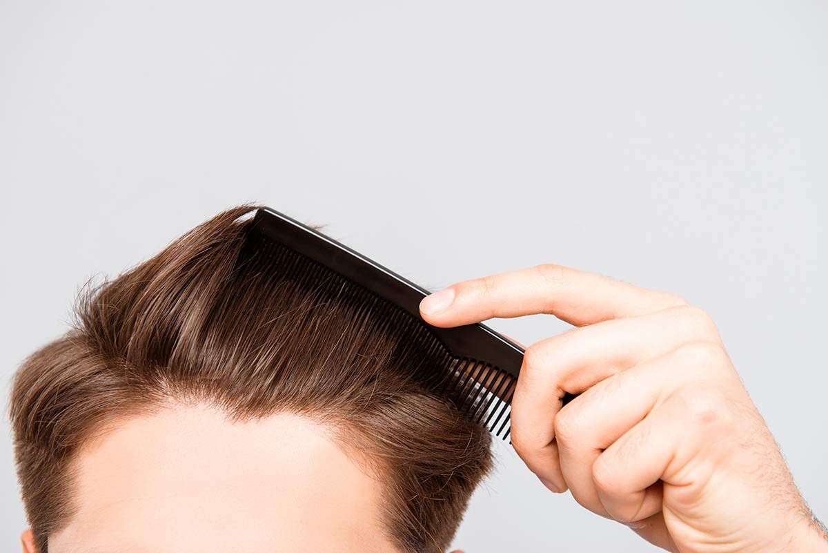 Revital Hair, el nuevo tratamiento capilar de la Dra. Carmen Martín en Madrid para la alopecia y pérdida de pelo